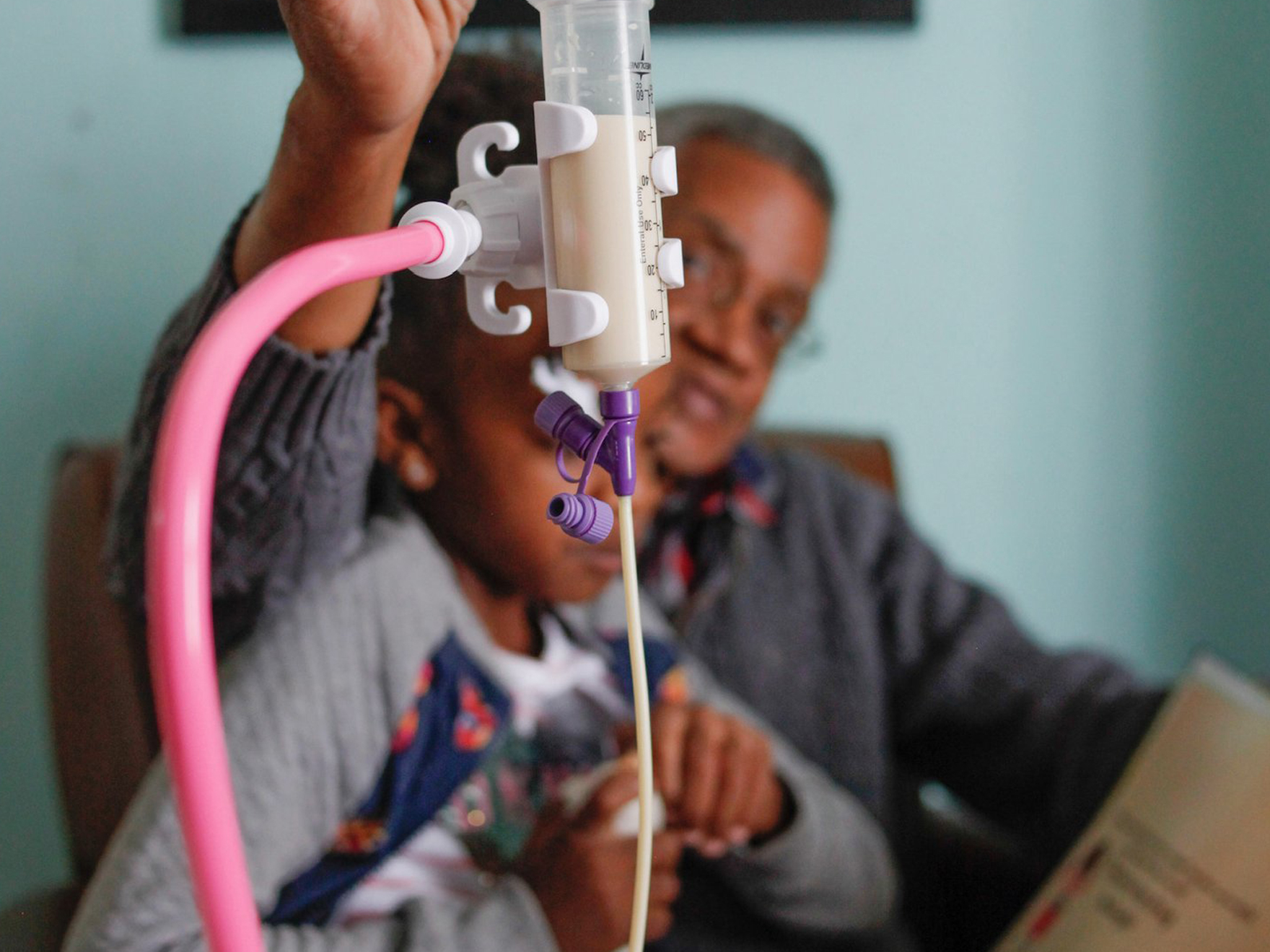 Types of Enteral Feeding | Feeding Tube Awareness NZ
