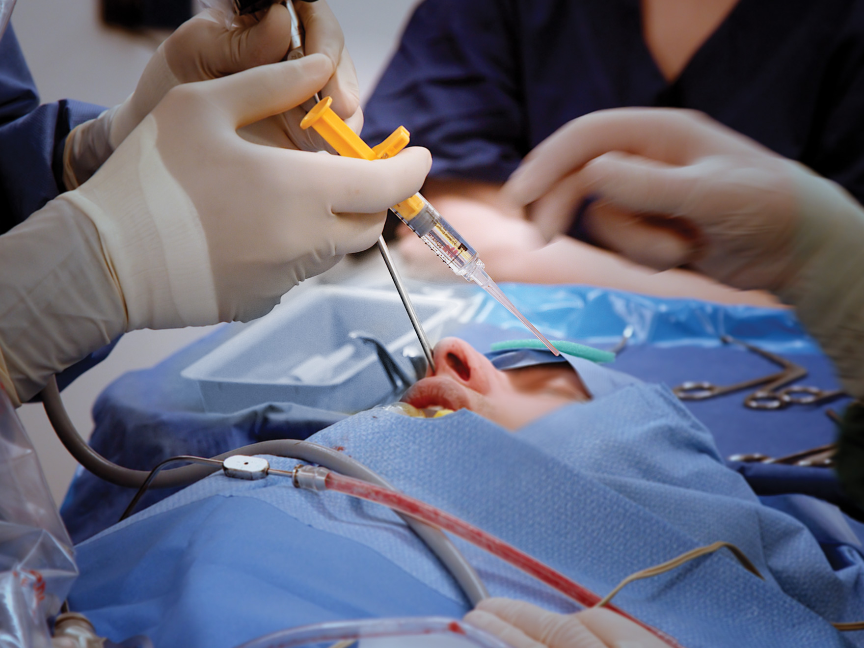 PuraStat® in ENT Endonasal Surgery | haemostatic solution